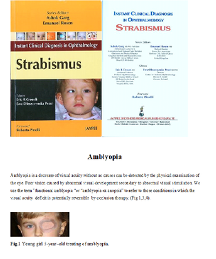 Tekst strabismus